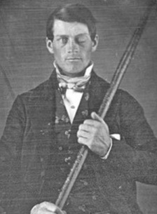 Lee más sobre el artículo El caso Phineas Gage: las emociones y la toma de decisiones